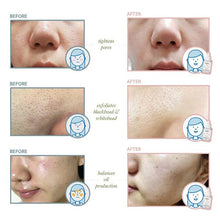 Load image into Gallery viewer, Beplain BHA Peeling Ampoule 30ml
